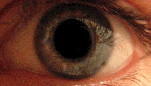 Eye_dilate